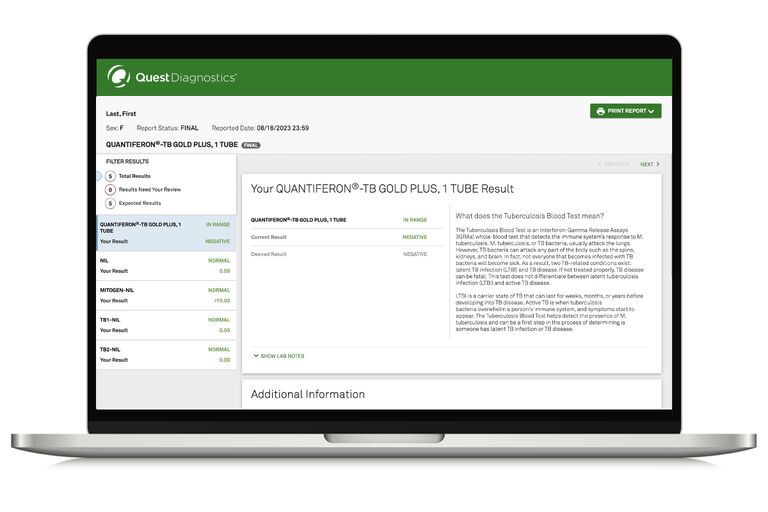 Tuberculosis Blood Test IGRA TB Blood Test Quest®